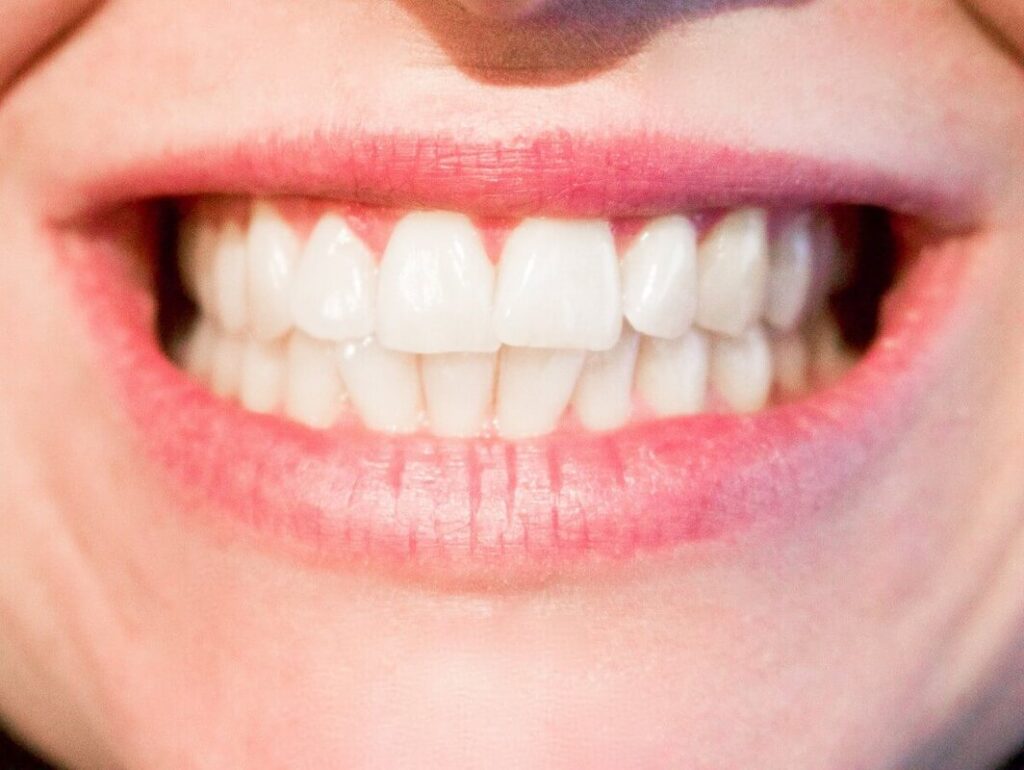 Why Dental Implants