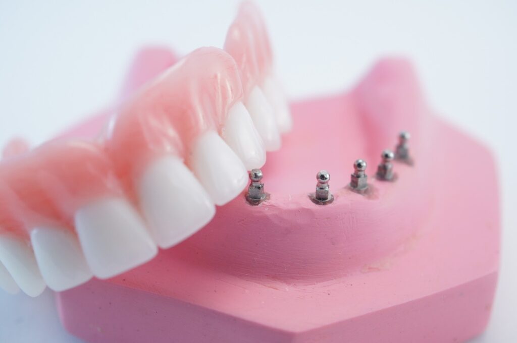 dentures-and-dental-implants