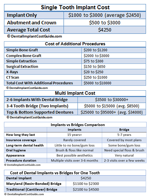 single teeth dental implant cost