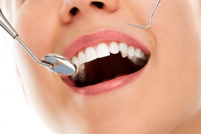 affordable dental care -Dental Implants Professionals-sydney
