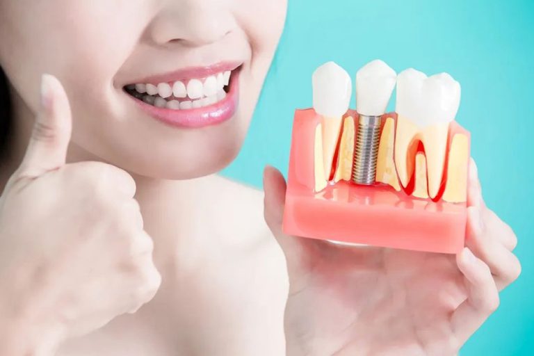Dental implants in Sydney as a transformative choice for a confident smile