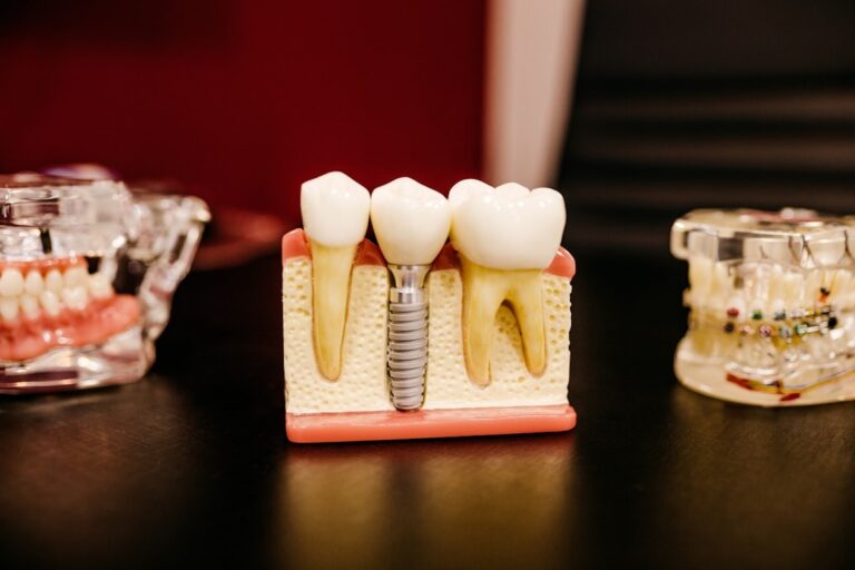 White and yellow objects symbolizing precision and care for dental implants in Sydney