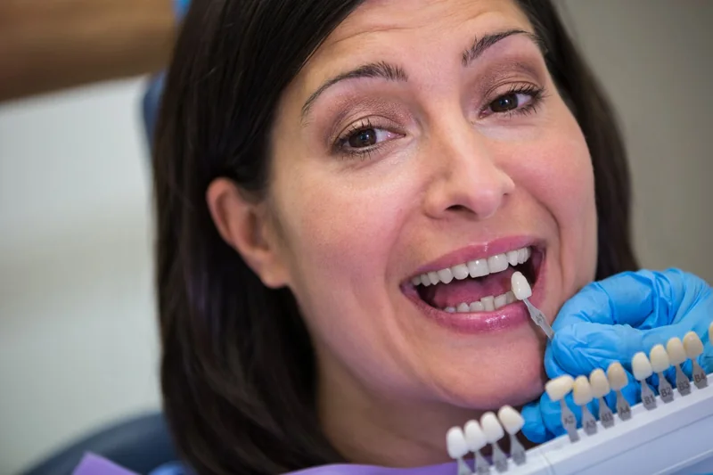 Single tooth implant consultation with dentist comparing dental implant tooth shade options