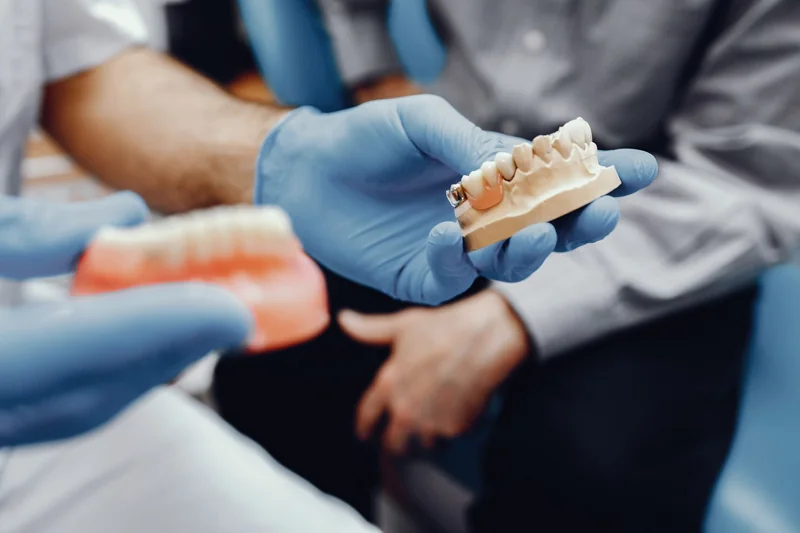 Dental bridge vs single tooth implant model demonstration for missing tooth replacement